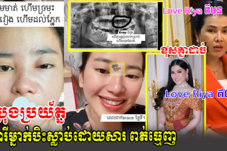 សូម​ប្រយ័ត្ន! បទពិសោធរបស់នារីម្នាក់ឈឺចាប់ស្ទើរស្លាប់ដោយសារការពត់ធ្មេញ(មានវីដេអូ)